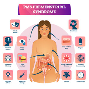 Syndrome prémenstruel